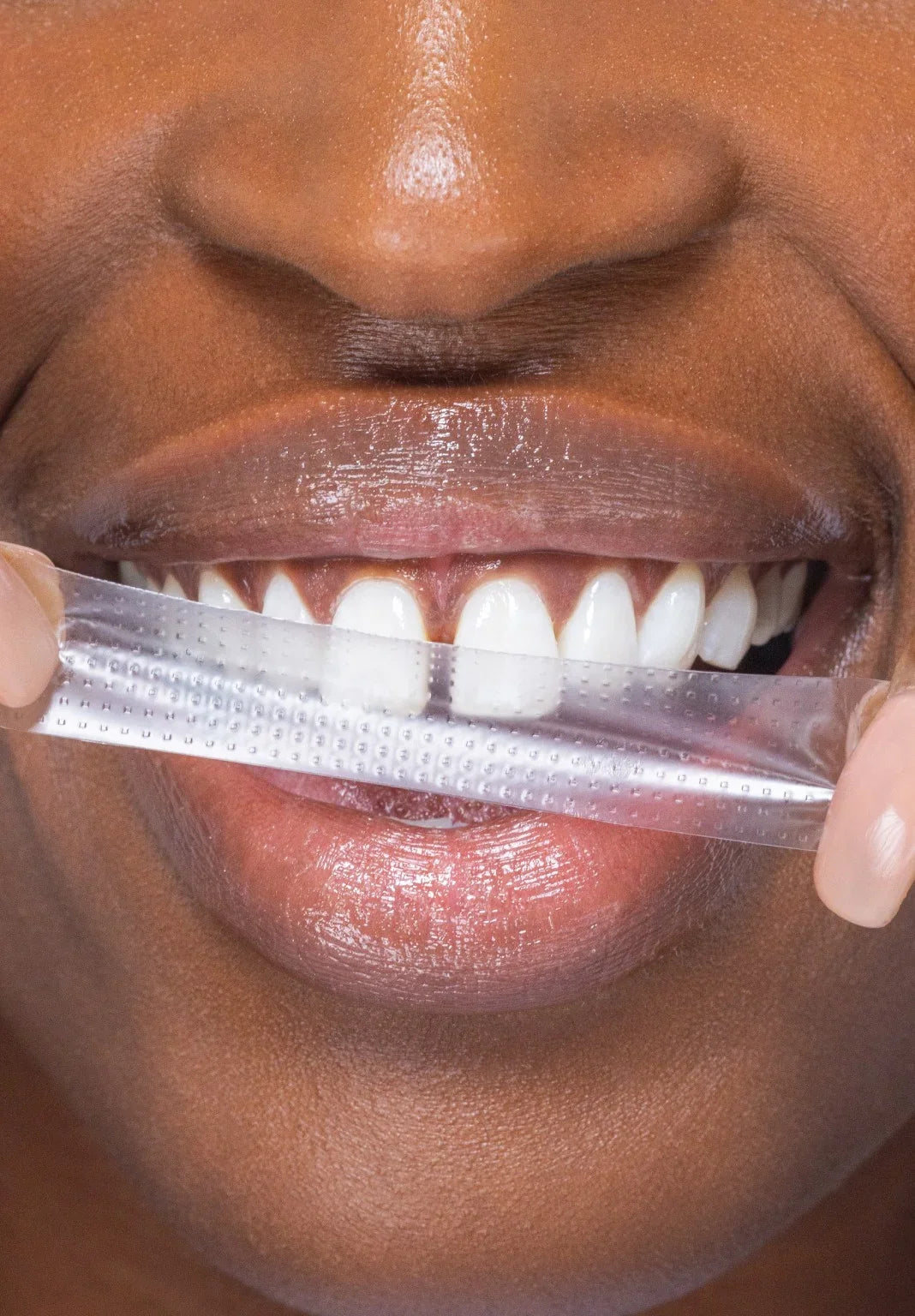 hismileteeth.de.com